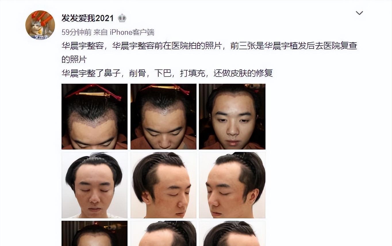 整容男星前后__男星健身前后对比